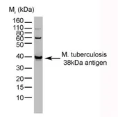 Anti-Mycobacterium tuberculosis 38 kDa antibody [BGN/1209/3875] used in Western Blot (WB). GTX39621