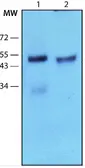 Anti-Parkin antibody [PRK8] used in Western Blot (WB). GTX39745