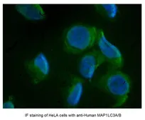 Anti-LC3A/B antibody, N-term used in Immunocytochemistry/ Immunofluorescence (ICC/IF). GTX39751