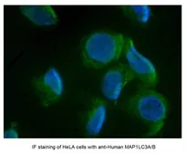 Anti-LC3A/B antibody, N-term used in Immunocytochemistry/ Immunofluorescence (ICC/IF). GTX39752