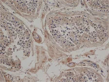 Anti-Jagged 2 antibody [HMJ2-1] used in IHC (Paraffin sections) (IHC-P). GTX39914