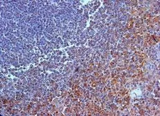 Anti-IL23 Receptor antibody, N-term used in IHC (Paraffin sections) (IHC-P). GTX39947