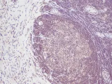 Anti-IL2 antibody used in IHC (Paraffin sections) (IHC-P). GTX39952