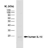 Anti-IL10 antibody [JES3-12G8] used in Western Blot (WB). GTX39962