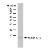 Anti-IL10 antibody [JES3-9D7] (Low endotoxin, azide free) used in Western Blot (WB). GTX39969