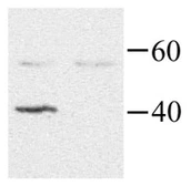 Anti-GNAI2 antibody used in Western Blot (WB). GTX40392