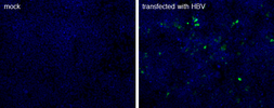 Anti-Hepatitis B virus Core Antigen antibody [C1] used in Immunocytochemistry/ Immunofluorescence (ICC/IF). GTX40523