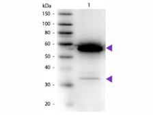 Anti-alpha Amylase antibody (HRP) used in Western Blot (WB). GTX40567