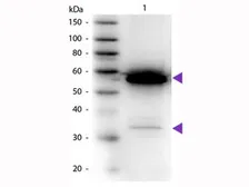 Anti-alpha Amylase antibody (HRP) used in Western Blot (WB). GTX40567