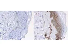 Anti-beta 2 Microglobulin antibody (HRP) used in IHC (Paraffin sections) (IHC-P). GTX40576