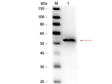 Anti-Glycerol kinase antibody (HRP) used in Western Blot (WB). GTX40600