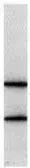 Anti-Digoxin antibody [3301] used in  (). GTX40814