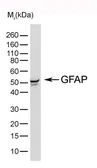 Anti-GFAP antibody [4A11] used in Western Blot (WB). GTX40985