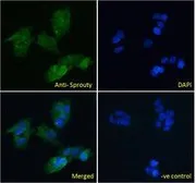 Anti-Sprouty 1 antibody, C-term used in Immunocytochemistry/ Immunofluorescence (ICC/IF). GTX41020