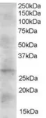 Anti-DKK2 antibody, C-term used in Western Blot (WB). GTX41187