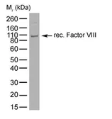 Anti-Factor VIII antibody [RFF-VIIIC/10] used in Western Blot (WB). GTX41190