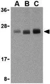Anti-TL1A antibody used in Western Blot (WB). GTX41272
