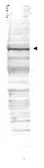 Anti-CDC27 antibody used in Western Blot (WB). GTX41386