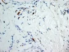 Anti-Dectin-1 antibody [2A11] (Low endotoxin, azide free) used in IHC (Frozen sections) (IHC-Fr). GTX41471