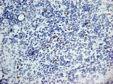 Anti-Dectin-1 antibody [2A11] used in IHC (Frozen sections) (IHC-Fr). GTX41473