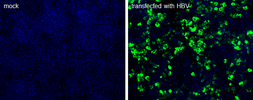 Anti-Hepatitis B virus Surface Antigen antibody [S 26] used in Immunocytochemistry/ Immunofluorescence (ICC/IF). GTX41800