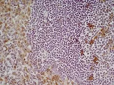 Anti-CD68 antibody [FA-11] used in IHC (Frozen sections) (IHC-Fr). GTX41866