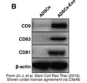 Anti-CD63 antibody [AD1] used in Western Blot (WB). GTX41877