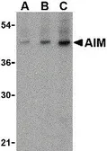 Anti-CD5L antibody, N-term used in Western Blot (WB). GTX41902