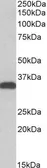 Anti-CBR3 antibody, C-term used in Western Blot (WB). GTX41958
