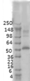 Anti-CaMKII alpha antibody [6G9] used in Western Blot (WB). GTX41976