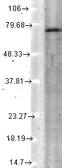 Anti-KCNQ4 antibody [S43-6] used in Western Blot (WB). GTX41990