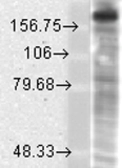 Anti-NMDAR2B antibody [S59-36] used in Western Blot (WB). GTX42016