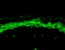 Anti-Nav1.8 antibody [S134-12] used in IHC (Paraffin sections) (IHC-P). GTX42021