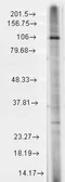 Anti-TRPC7 antibody [S64A-36] used in Western Blot (WB). GTX42022