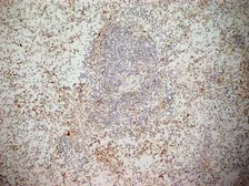 Anti-NKG2D antibody [1D11] used in IHC (Frozen sections) (IHC-Fr). GTX42086