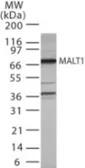 Anti-MALT1 antibody used in Western Blot (WB). GTX42103