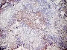 Anti-CD3 antibody [KT3] used in IHC (Frozen sections) (IHC-Fr). GTX42105