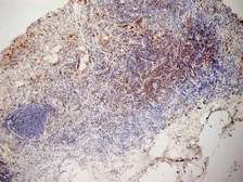 Anti-CD3 antibody [KT3] used in IHC (Frozen sections) (IHC-Fr). GTX42106