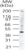 Anti-TRIB3 antibody used in Western Blot (WB). GTX42107