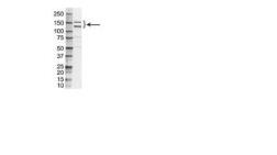 Anti-MUC1 antibody [VU-3C6] used in Western Blot (WB). GTX42238