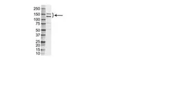 Anti-MUC1 antibody [VU-3C6] used in Western Blot (WB). GTX42238