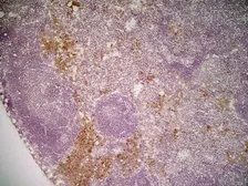 Anti-Mannose Receptor antibody [MR5D3] used in IHC (Frozen sections) (IHC-Fr). GTX42264