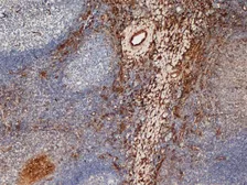 Anti-Mannose Receptor antibody [7-450] used in IHC (Frozen sections) (IHC-Fr). GTX42267