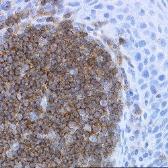 Anti-CD19 antibody [LE-CD19] used in IHC (Paraffin sections) (IHC-P). GTX42324