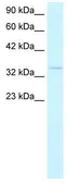 Anti-HEY1 antibody, C-term used in Western Blot (WB). GTX42614