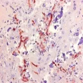 Anti-Aspergillus antibody [WF-AF-1] used in IHC (Paraffin sections) (IHC-P). GTX42724