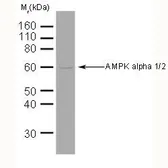 Anti-AMPK alpha 1 + AMPK alpha 2 antibody [34.2] used in Western Blot (WB). GTX42789
