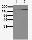 Anti-eNOS (phospho Ser1177) antibody [BDI250] used in Western Blot (WB). GTX42866