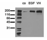 Anti-EGFR (phospho Tyr1173) antibody [9H2] used in Western Blot (WB). GTX42900