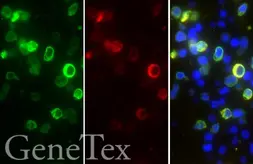 SARS-CoV-2 (COVID-19) Nucleocapsid FFPE 293T cell pellet Block. GTX435641